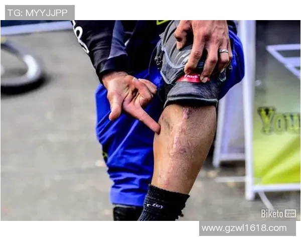 成都极限运动队比赛经验引发热议与争议的背后故事